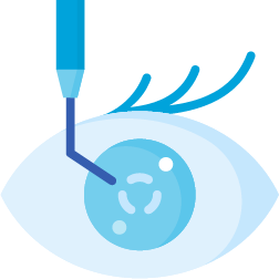 Intravitreale Medikamenten Eingabe