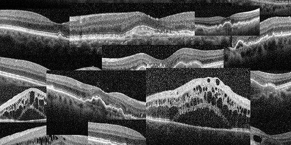 Content Bild AOZ Neuss für OCT