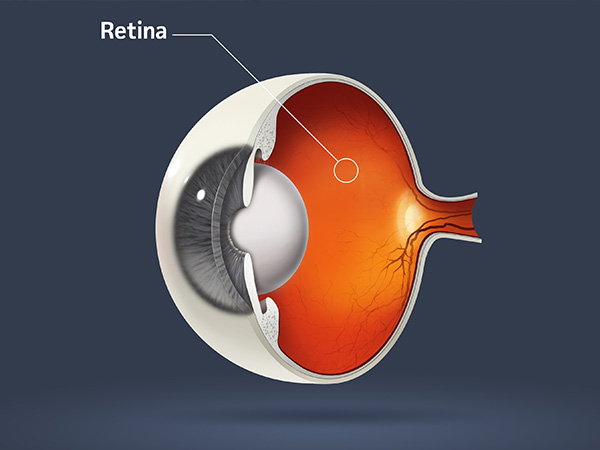 Netzhautbehandlung in Neuss am Hasenberg _ MVZ Augenärzte