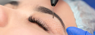 Medizinische Lidchirurgie